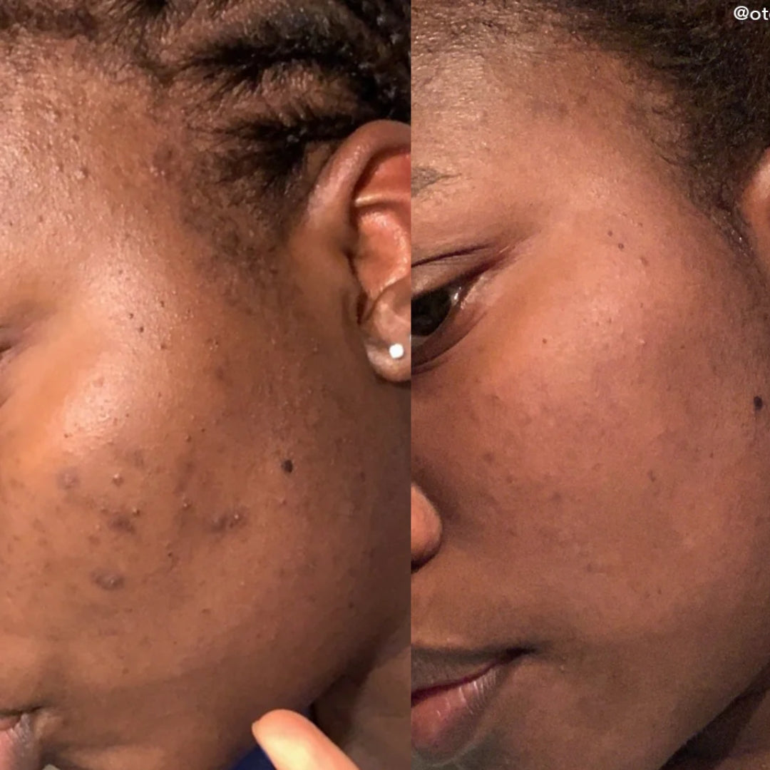 Serum Despigmentante Good Molecules - Discoloration | Depigmenting Serum - Discolaration