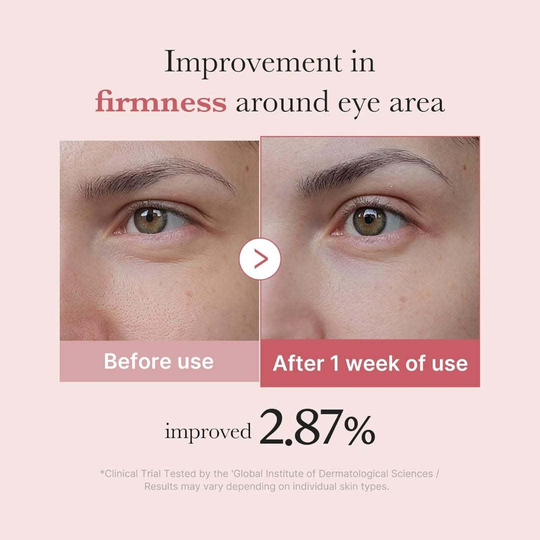 Contorno de ojos con PDRN de salmón, niacinamida y retinol 30 ml Medicube PDRN Pink Peptide Eye Cream