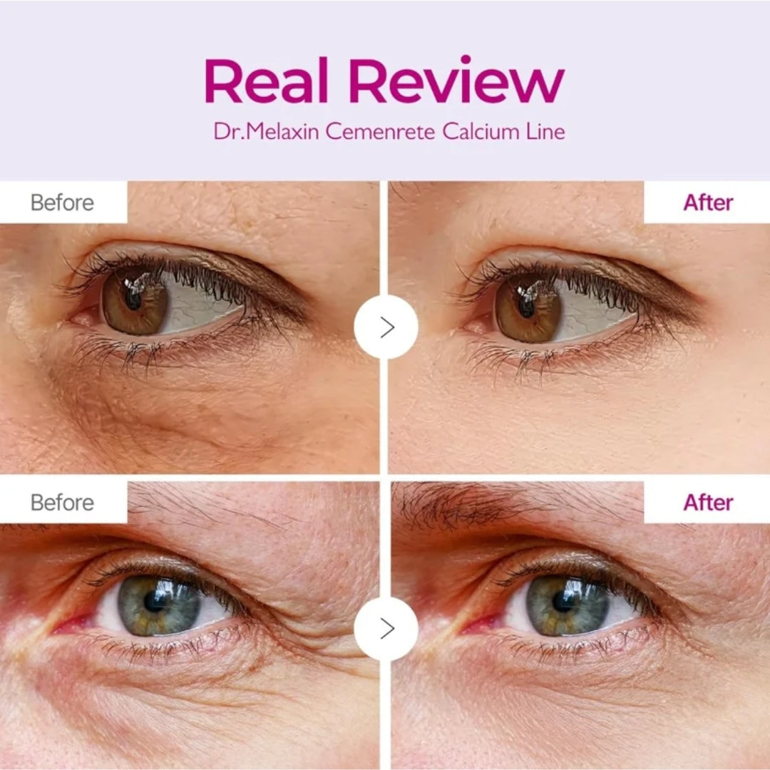 Balsmo facial Cemenrete Calcium Volume 9g Dr.Melaxin