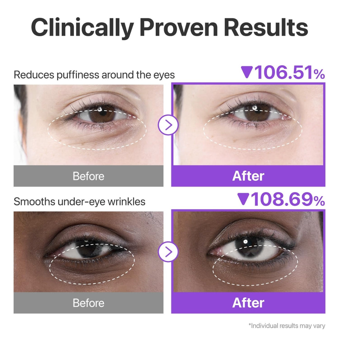Parches Para Ojos No.9 NAD+ 5 pares Collagen Under Eye Parches Numbuzin