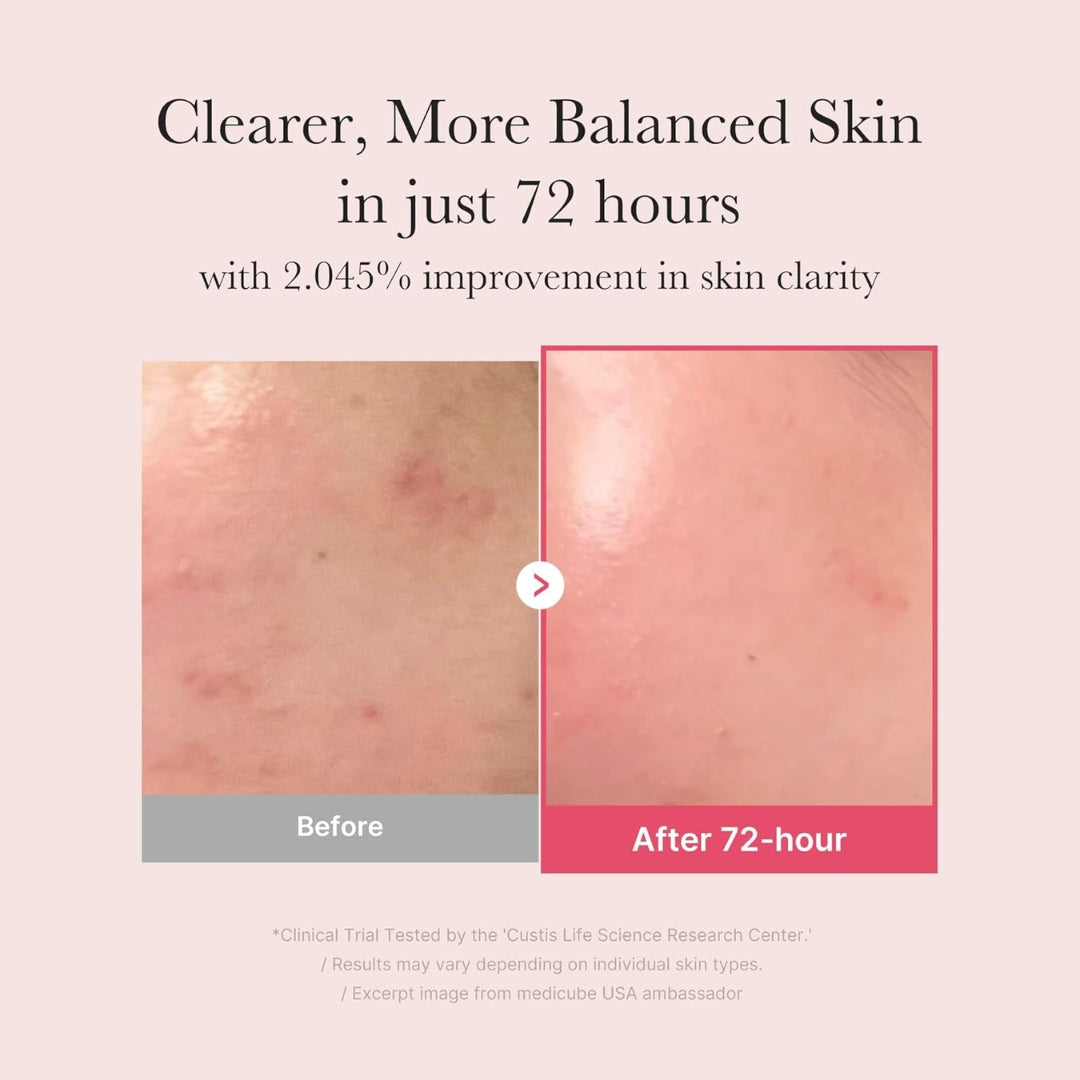 Serum Ácido Tranexámico, Niacinamida, y 2% de Arbutina Medicube