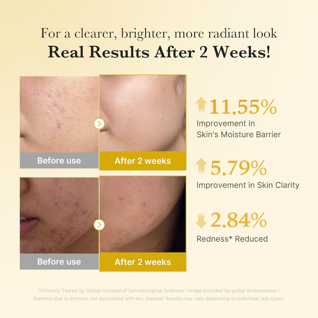 Serum Kojic Acid Turmeric Niacinamide Medicube