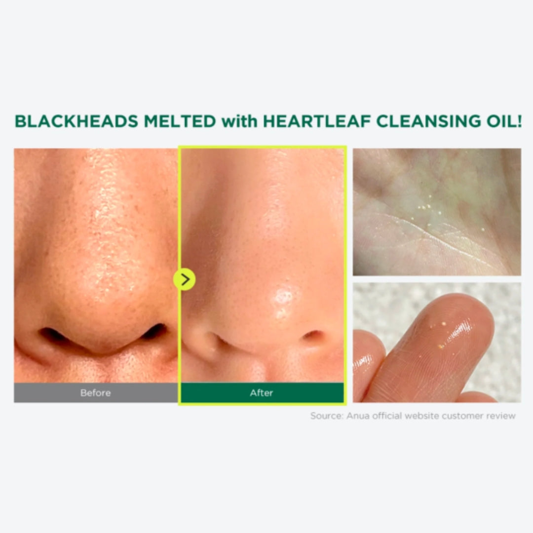 Limpiador en Aceite Facial Para Poros Anua - Pore Facial Oil Cleanser 200ml