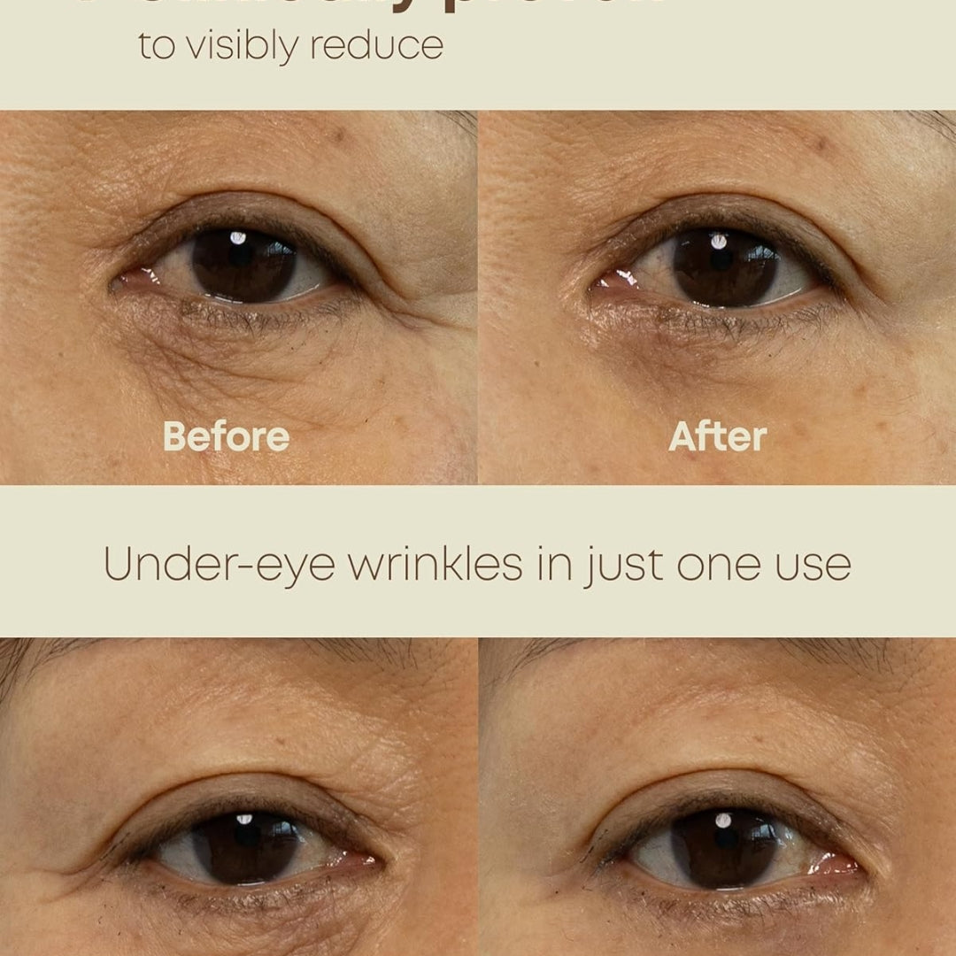 Crema para el contorno de ojos Ever -Youth de doble efecto nine less