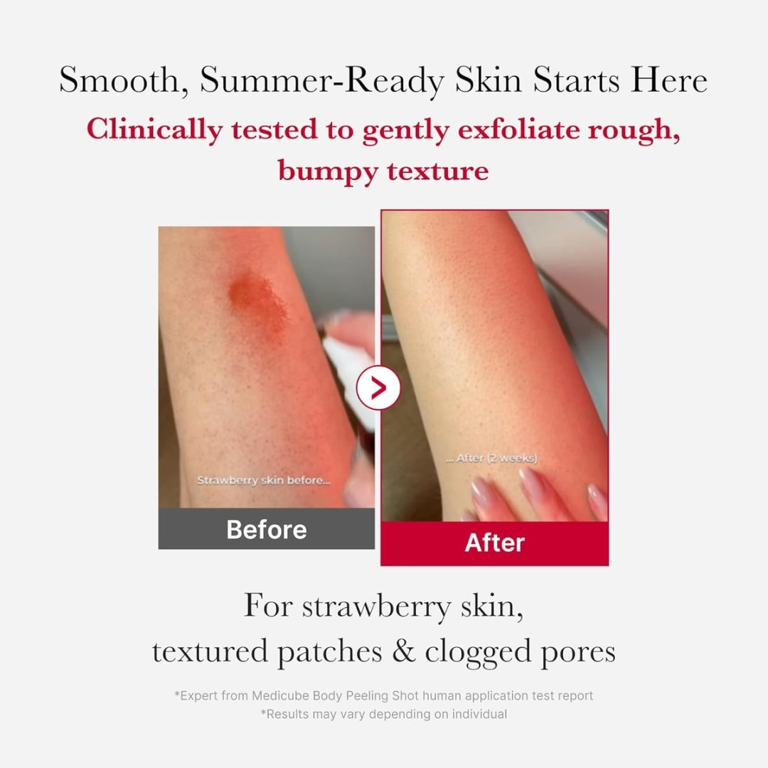Red Acne Body Peeling Shot 110g Medicube