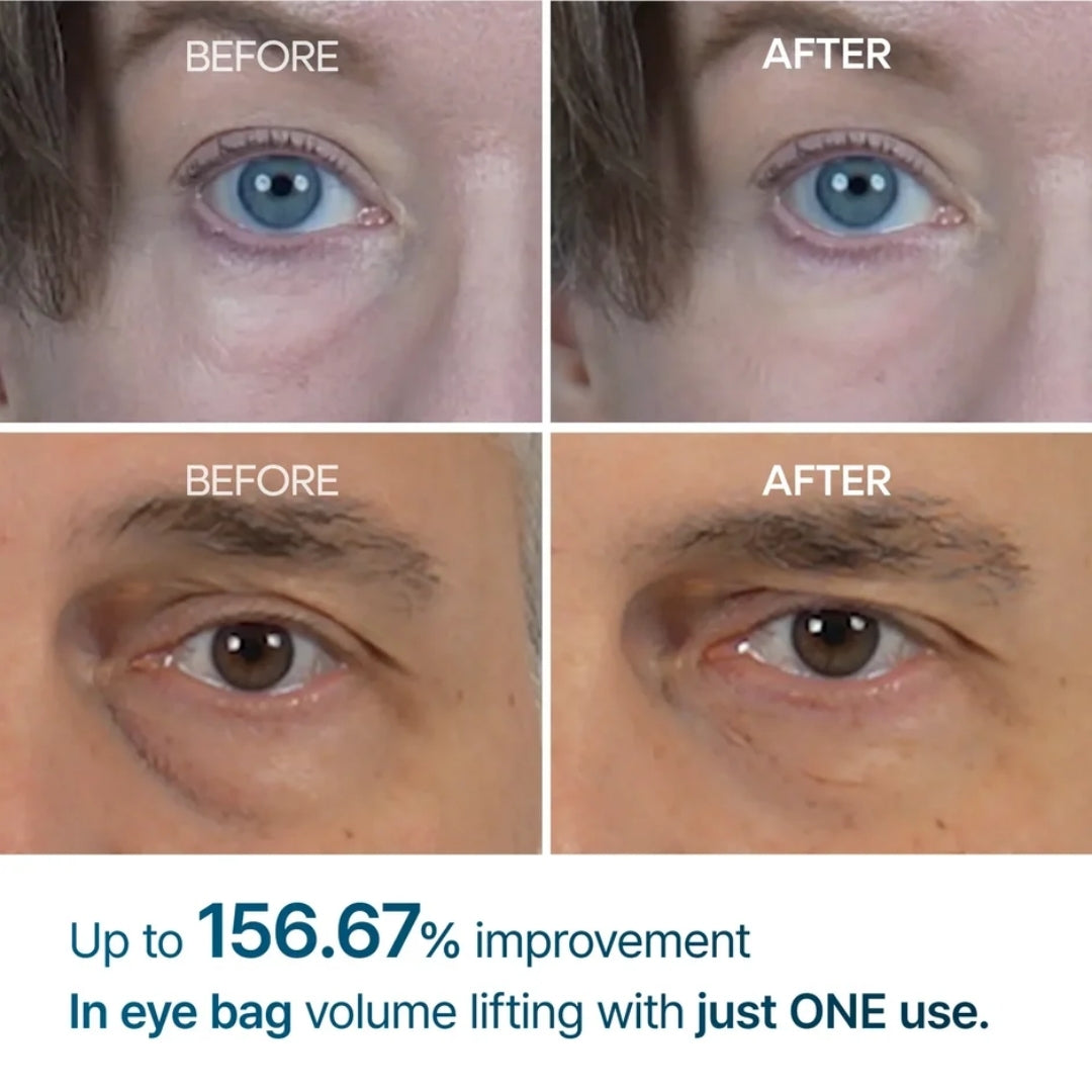 Contorno de ojos para bolsas Eyephalt Eyebag Cream Dr.Melaxin