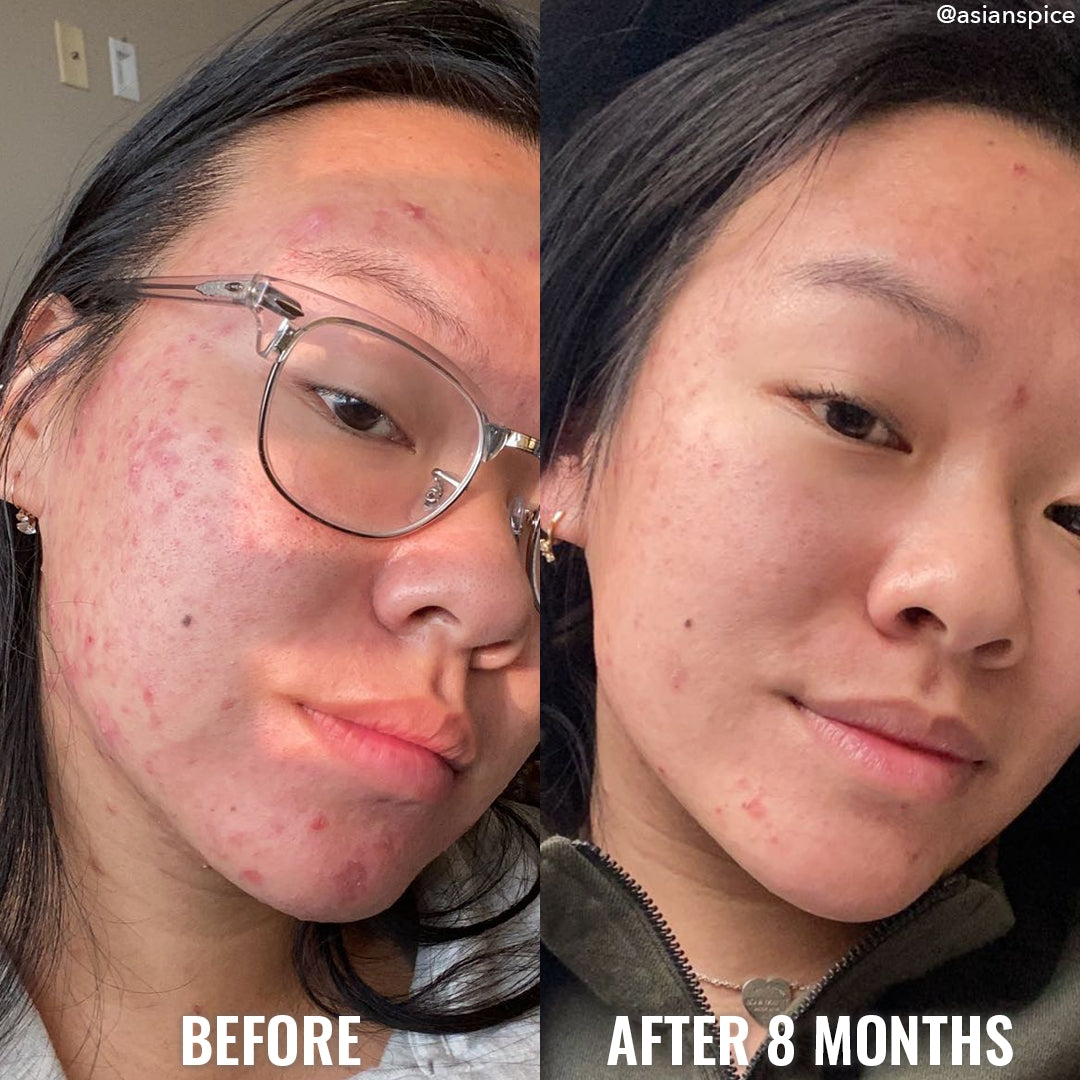 Serum  Despigmentante Good Molecules - Discoloration | Depigmenting Serum - Discolaration