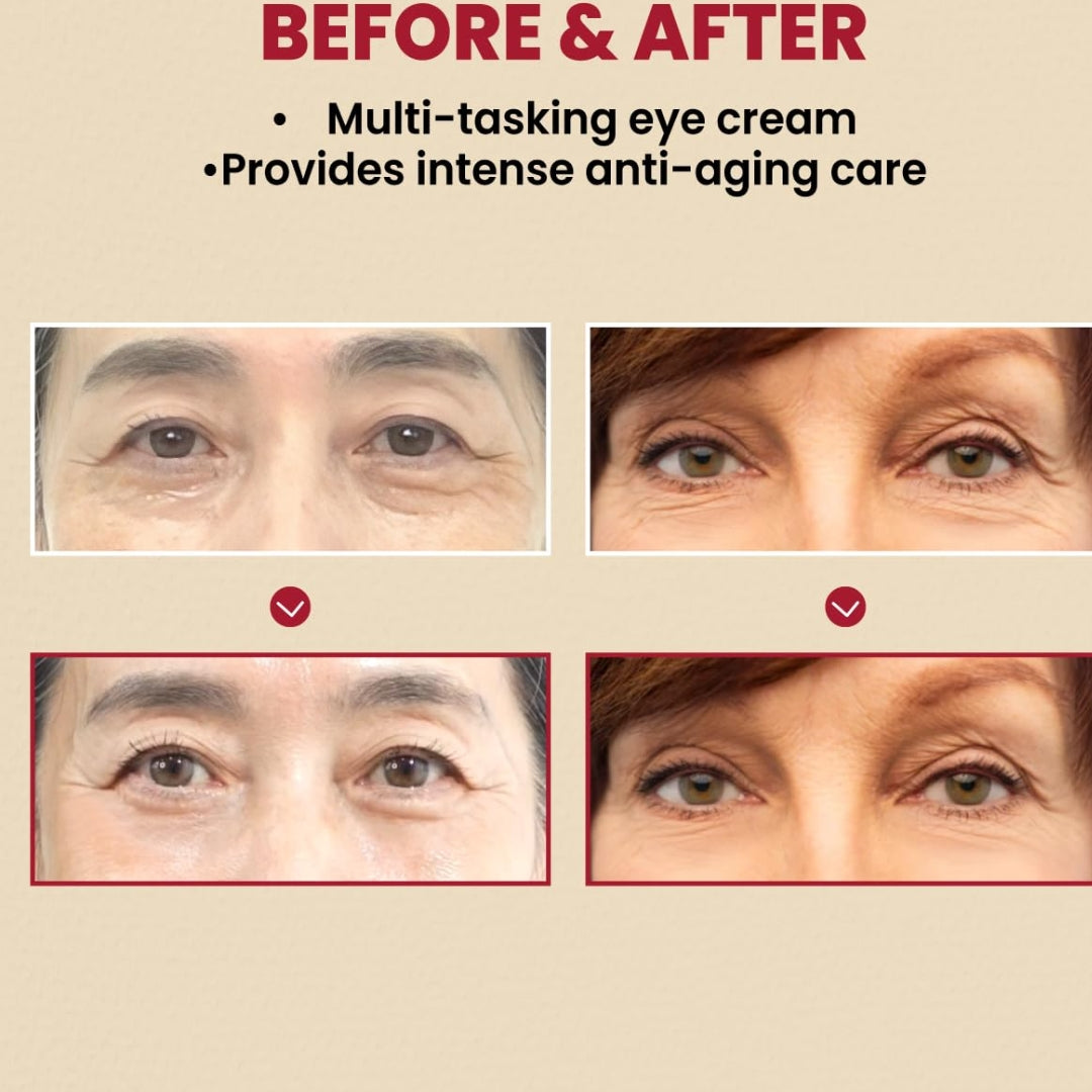 Contorno de Ojos Eye Cream : Retinal Liposome 4% + Fermented Bean Seoul 1988 K-SECRET