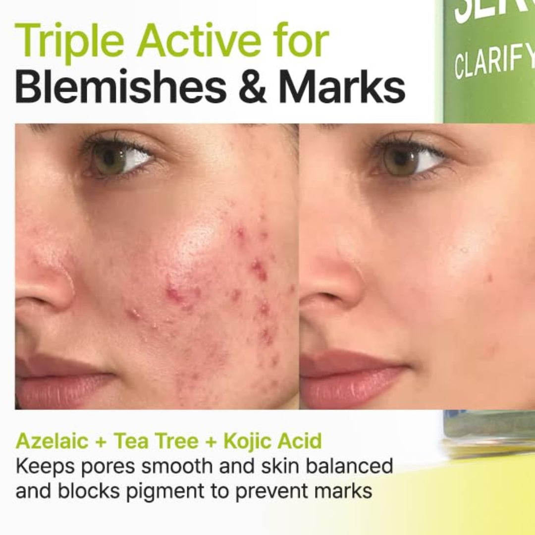 Serum de Azelaic Acid 10 Kojic Tea Tree  Purito
